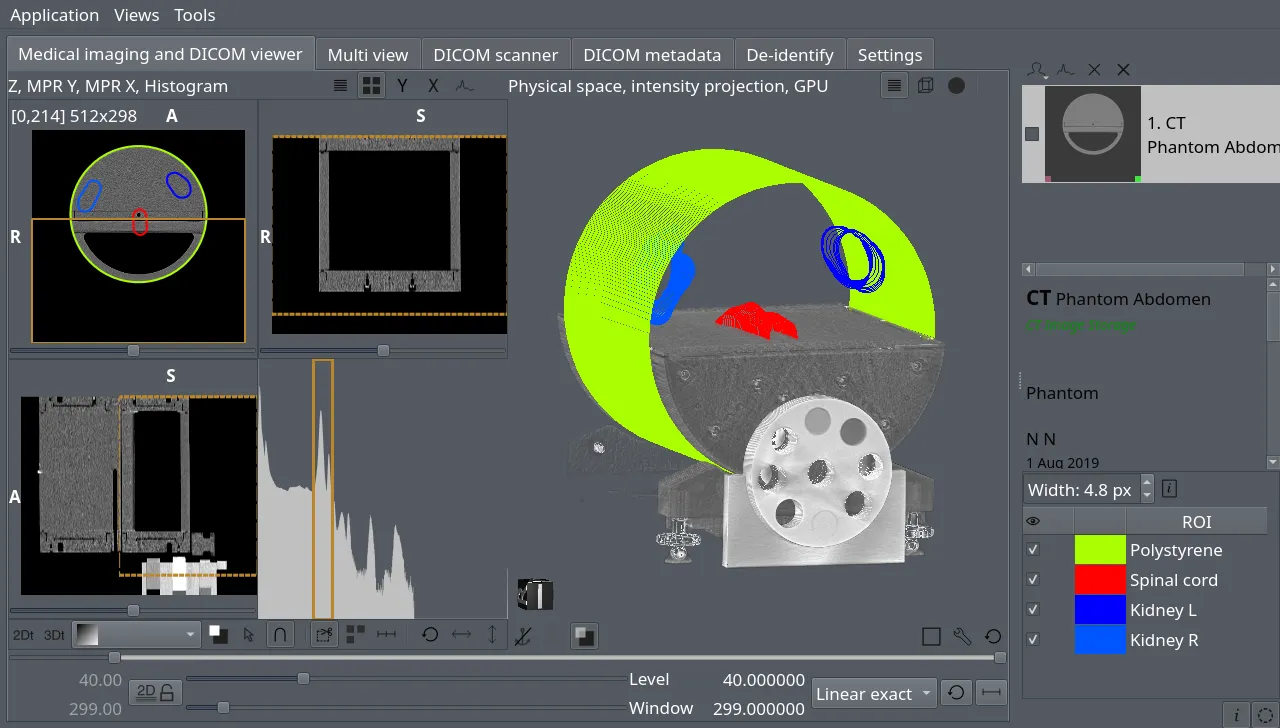Main Window, RTSTRUCT, Physical Space View
